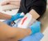 How to Apply Occlusive Dressing: Step-by-Step Guide for Gunshot Wound Care