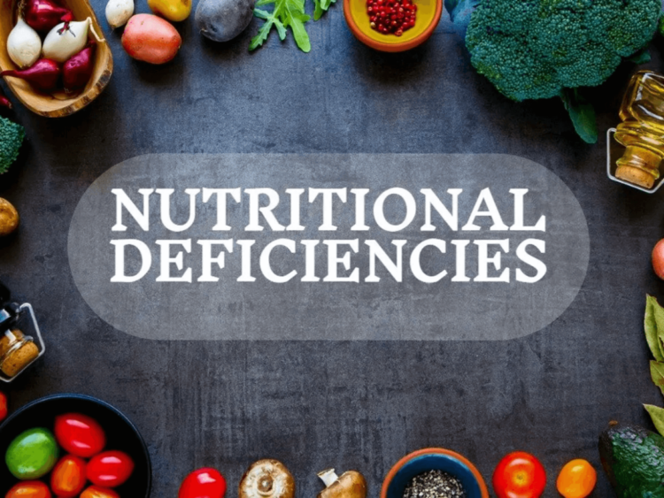 Nutritional Deficiencies