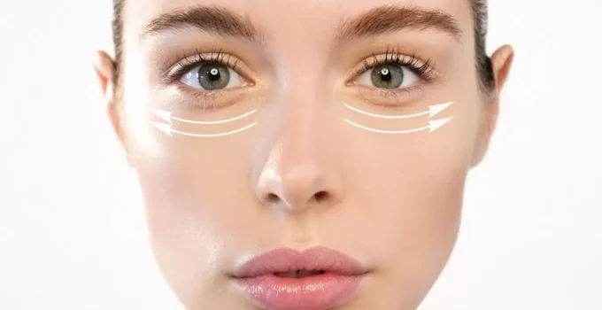 Remove Eye Bag Treatments Effectively: Your Comprehensive Guide to Revitalized Eyes